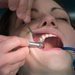 Hrad zdravotn pojiovna trhn zub vnarkze u zubae?