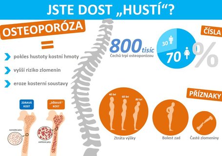 FOTKA - Ubvte na vce nebo jste ena po menopauze? Pozor na epidemii dravch kost