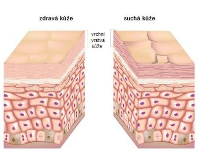 FOTKA - Mte suchou ki? Zkuste vitamny!