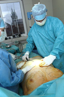 FOTKA - Transplantace tuku odebr a zrove pidv tam, kde je poteba