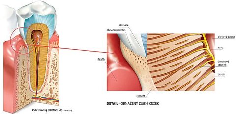 FOTKA - O citliv zuby je teba se starat, ne se problmu vyhbat