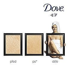 Dove