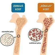 Ubvte na vce nebo jste ena po menopauze?