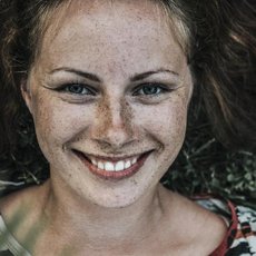 Zima je vhodnou dobou k odstranění znamének, jizev či pigmentových skvrn Zima je vhodnou dobou k odstranění znamének, jizev či pigmentových skvrn