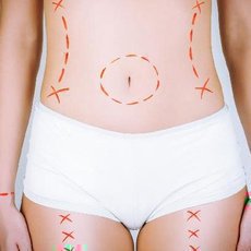 Odborníci varují před nekvalitně provedenými plastikami Odborníci varují před nekvalitně provedenými plastikami