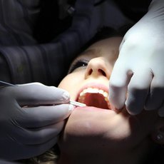 Rtuť v amalgámových plombách je škodlivá, omezování přijde již v příštím roce Rtuť v amalgámových plombách je škodlivá, omezování přijde již v příštím roce