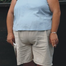 obezita