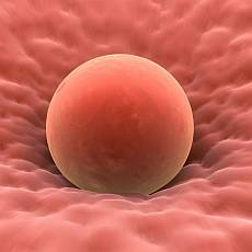 Vysazen hormonln antikoncepce zpsob vtin en problmy s cyklem