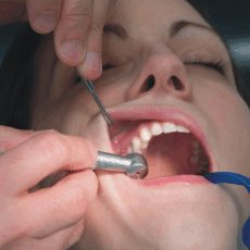 nvtva u zubae v thotenstv
