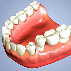 titanov zubn implantty