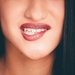 5 astch pin bolesti zub, kter byste nemli pehlet
